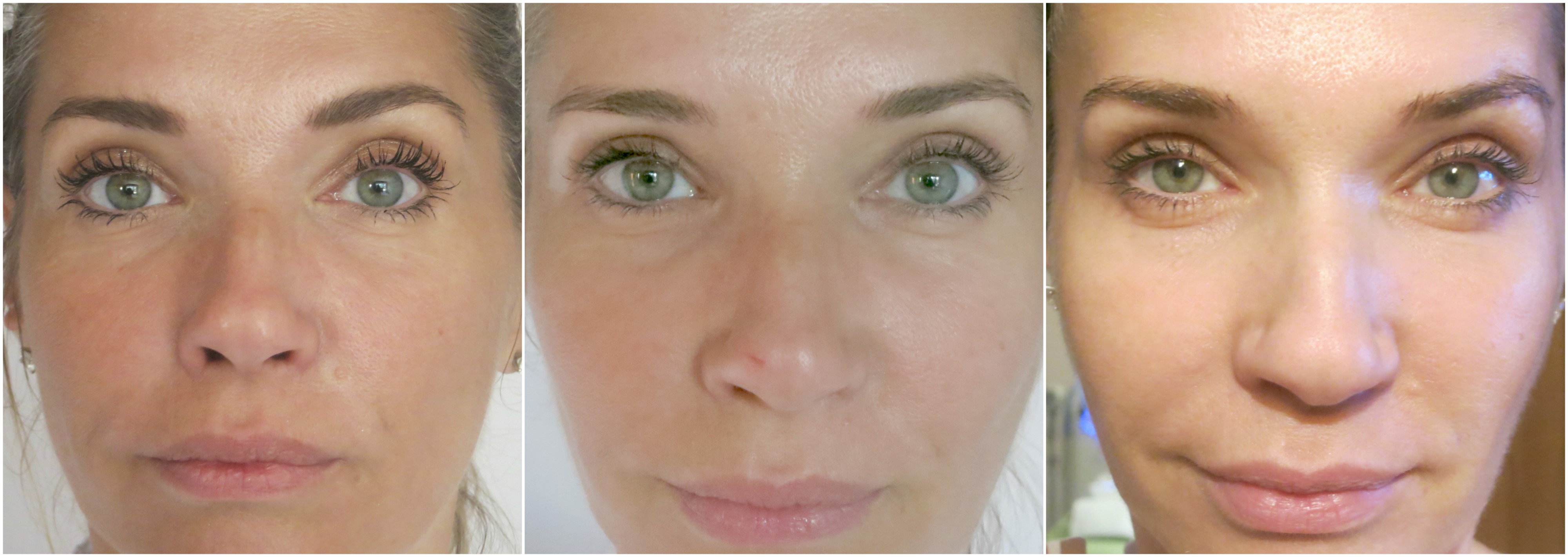 ba-full-face